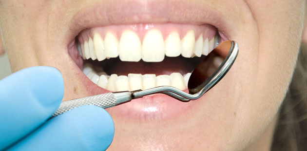 Prevenzione e igiene orale - dentista Dental Più